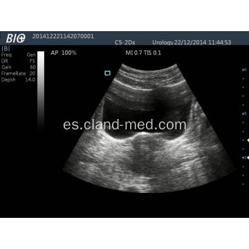 Escáner de ultrasonido portátil Digital Ultrasound Machine Price